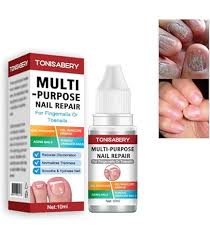 Multi purpose nail repair